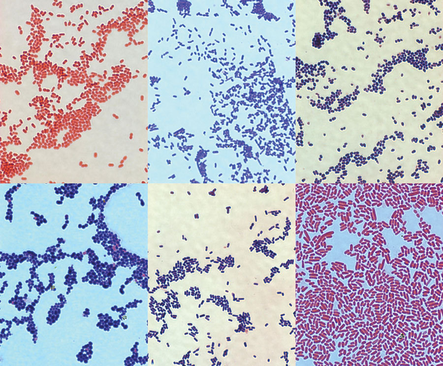 Gram positive bacteria, shown in blue here, are the most common source of infection in the ethanol production process. Gram negative bacteria are pictured in pink. 